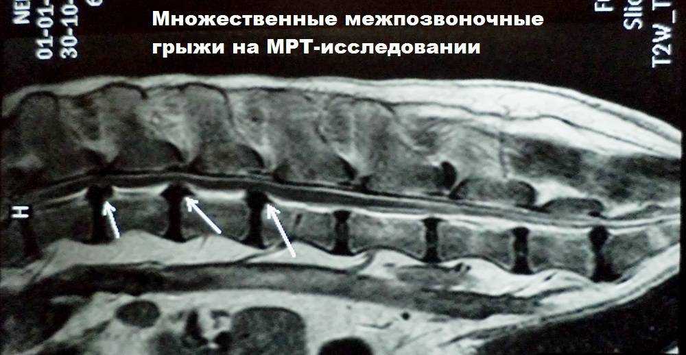 Лечение грыжи у собак в спб