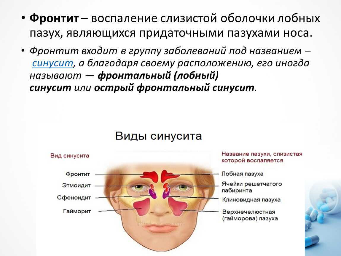 Гайморит у кошек. причины и симптомы. возможные осложнения. диагностика. лечение. профилактика