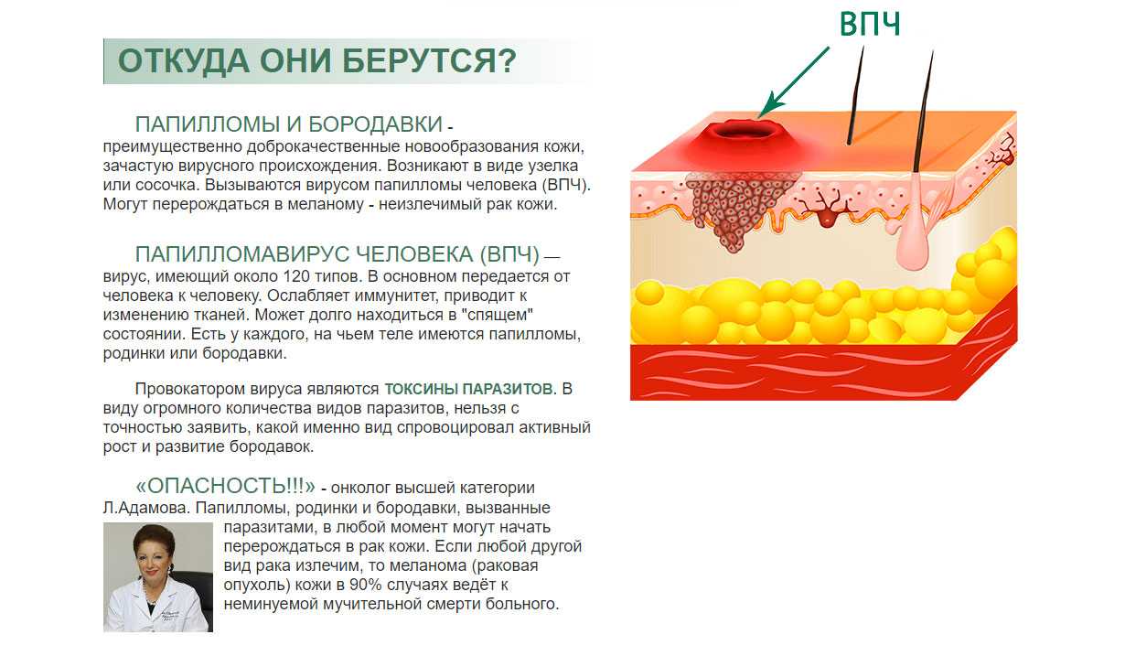 Как лечить папилломы у собак?