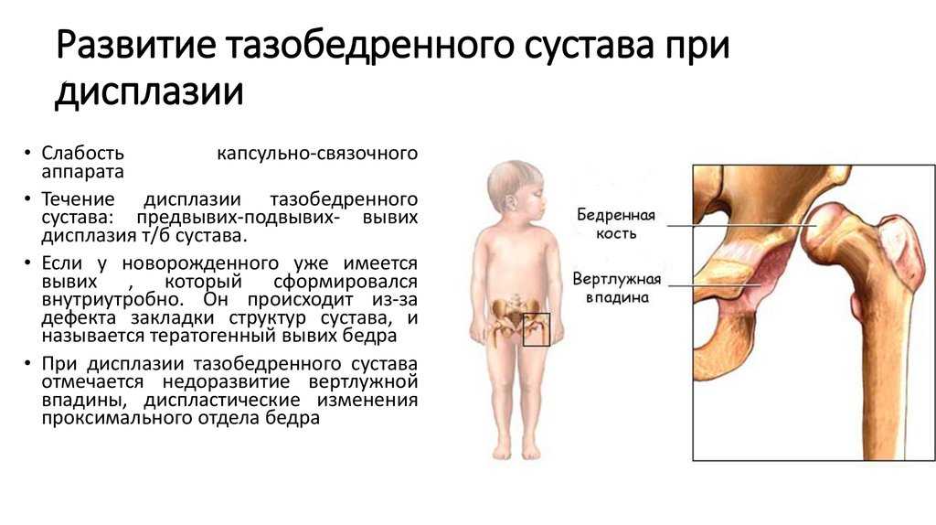 Дисплазия суставов (тазобедренных, локтевых, запястных) у кошек - симптомы, лечение, препараты, причины появления | наши лучшие друзья