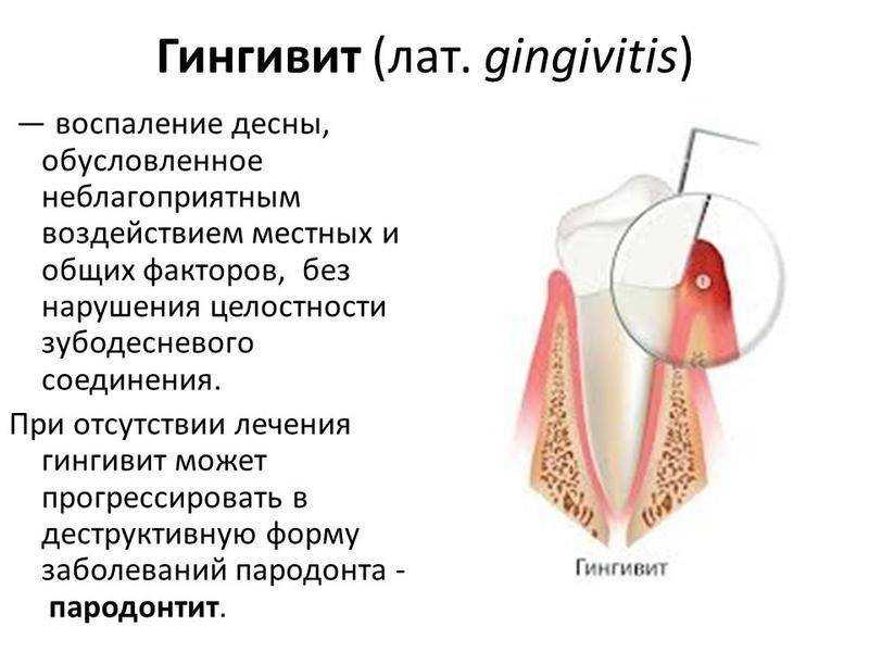 Болезни зубов у кошек