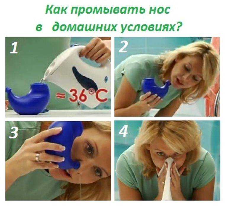 Как промыть нос кошке или котенку в домашних условиях, что лучше использовать?