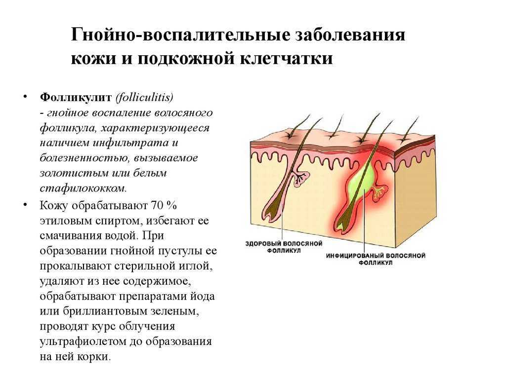 Абсцесс у кошек: причины возникновения, что делать если вскрылся, лечение нарыва в домашних условиях