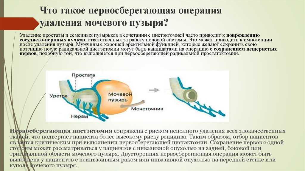 Атония мочевого пузыря у кота: симптомы и лечение