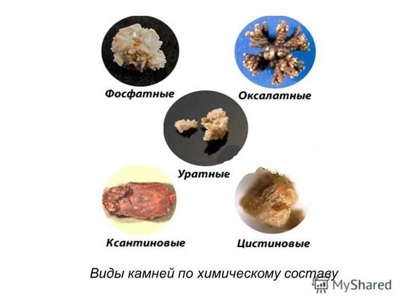 Мочекаменная болезнь у котов: причины и лечение