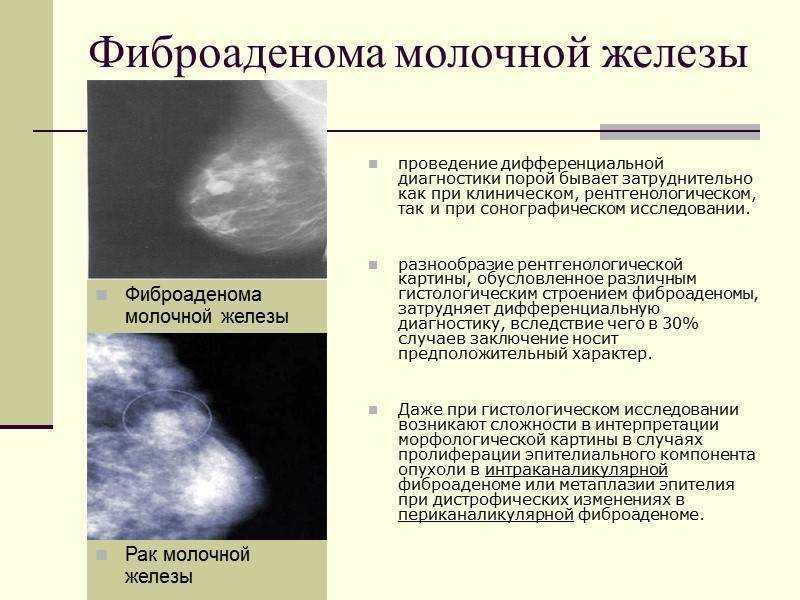 Мастопатия у кошек - лечение в домашних условиях