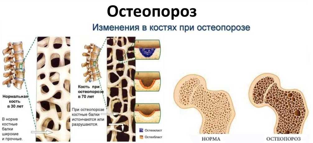 Рахит у собаки или щенка: симптомы, причины, эффективные методы лечения