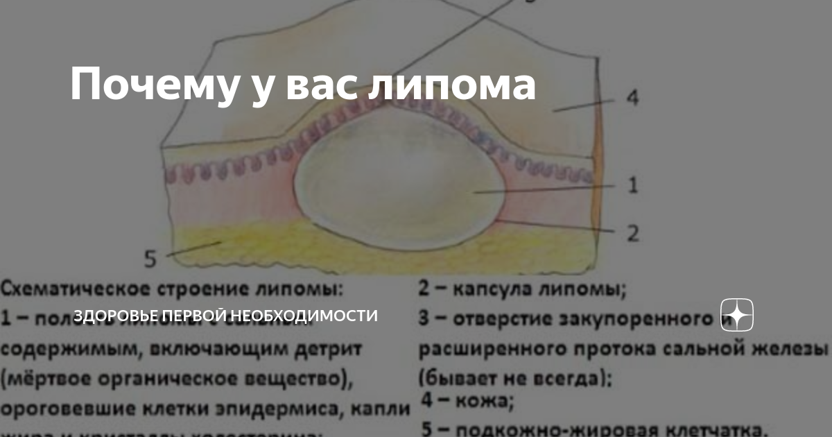 Жировик липома у собаки: описание с фото, причины образования, возможные последствия, диагностика, способы лечения и удаления