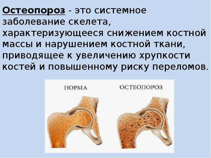 Остеопороз у собак: причины и способы лечения