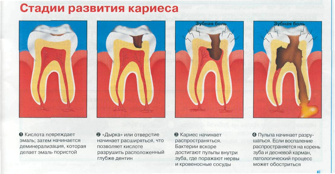 Зубные проблемы, их лечение и профилактика