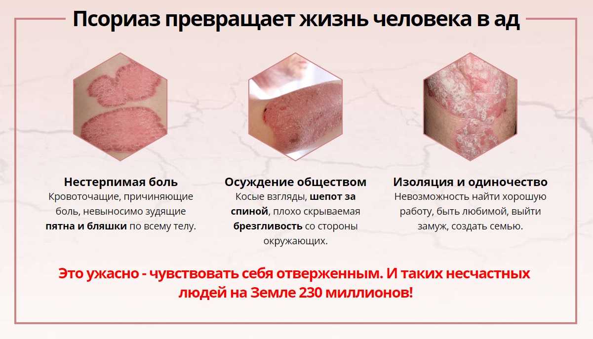 От псориаза у кошек