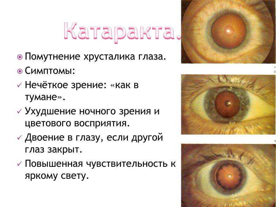 Болезни глаз у собак: классификация и лечение