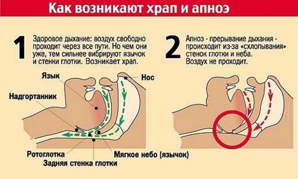 Почему коты дергаются во сне?