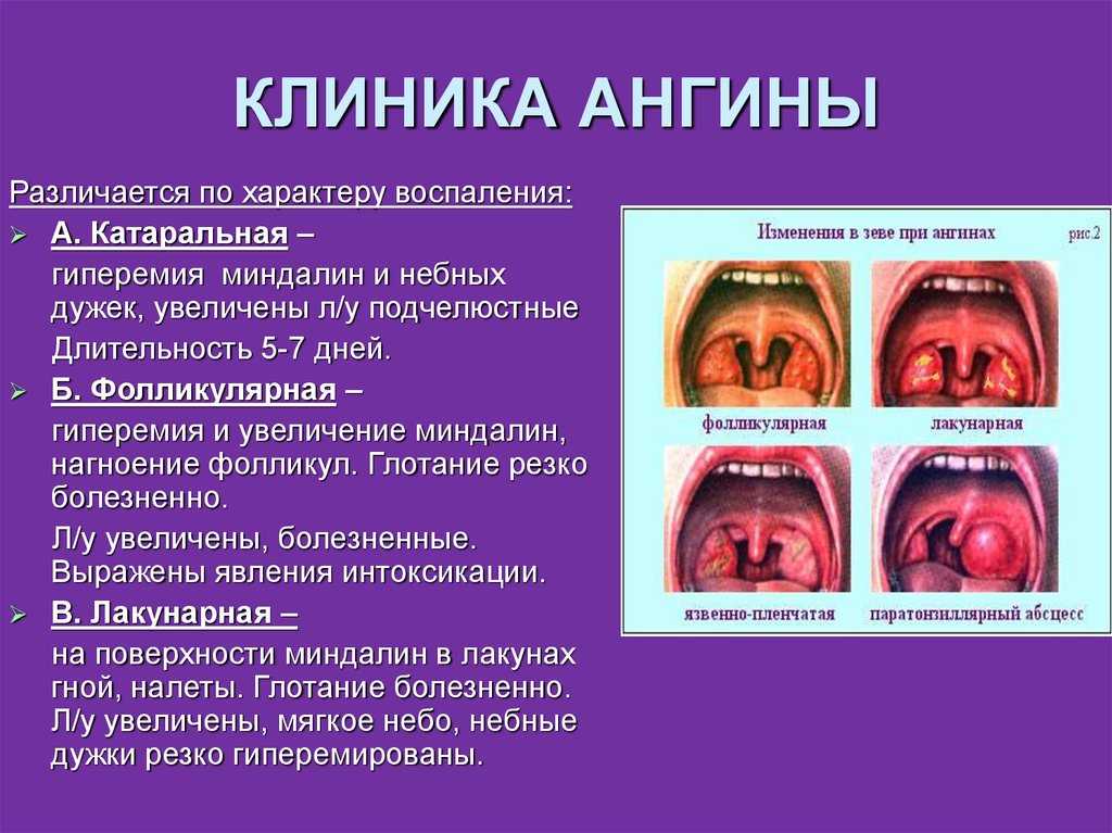Ангина у собак симптомы и лечение