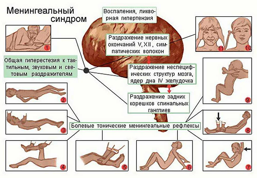 Воспалительные заболевания центральной нервной системы у собак. ветеринарная клиника "зоостатус"