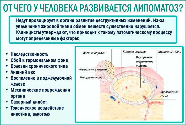 Жировик (липома) у собак: симптомы, лечение, фото
жировик (липома) у собак: симптомы, лечение, фото