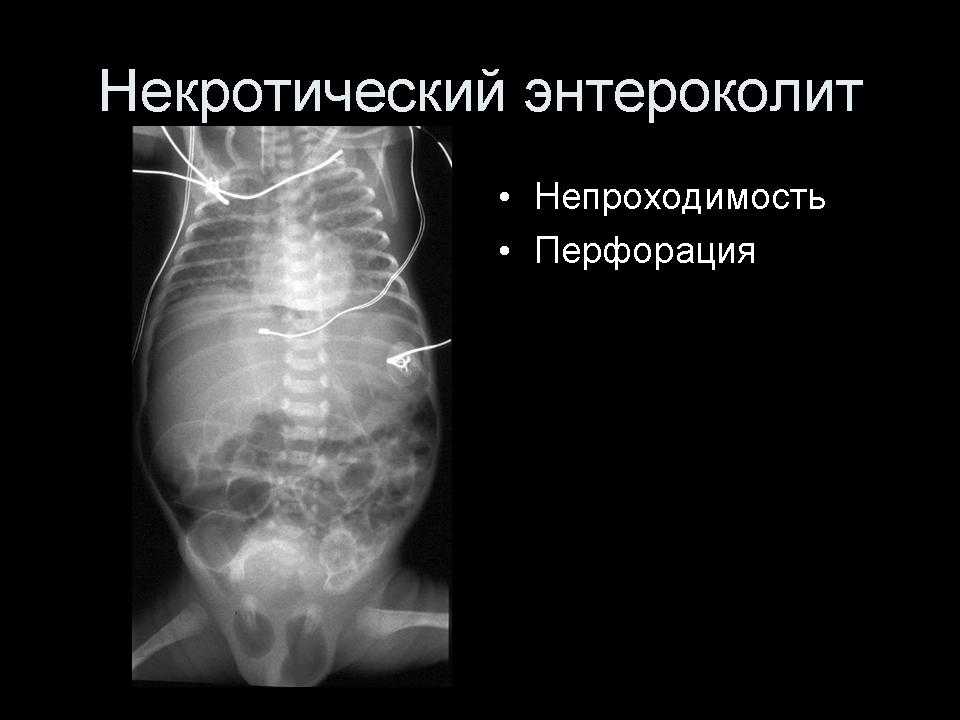 Энтероколит у собаки - причины развития, симптомы и лечение