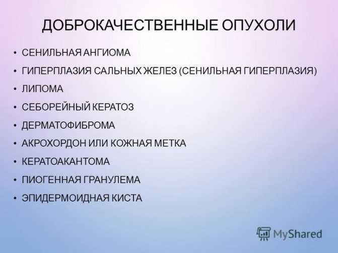 Меланома