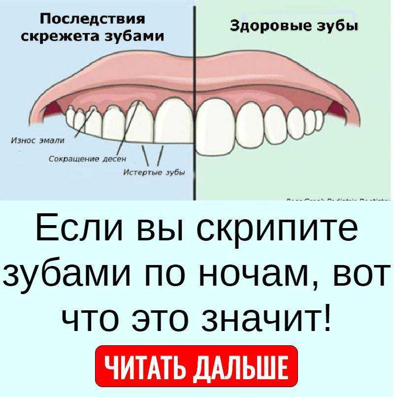 Хозяева домашних питомцев иногда слышат, как кошка скрипит зубами Этот звук животное может издавать во время еды, сна, бодрствования Причины могут быть