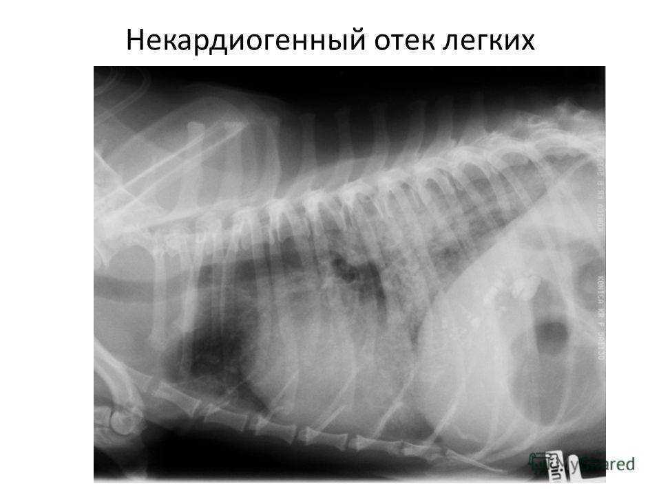 Отек легких у кошек: первые признаки, диагностика и лечение