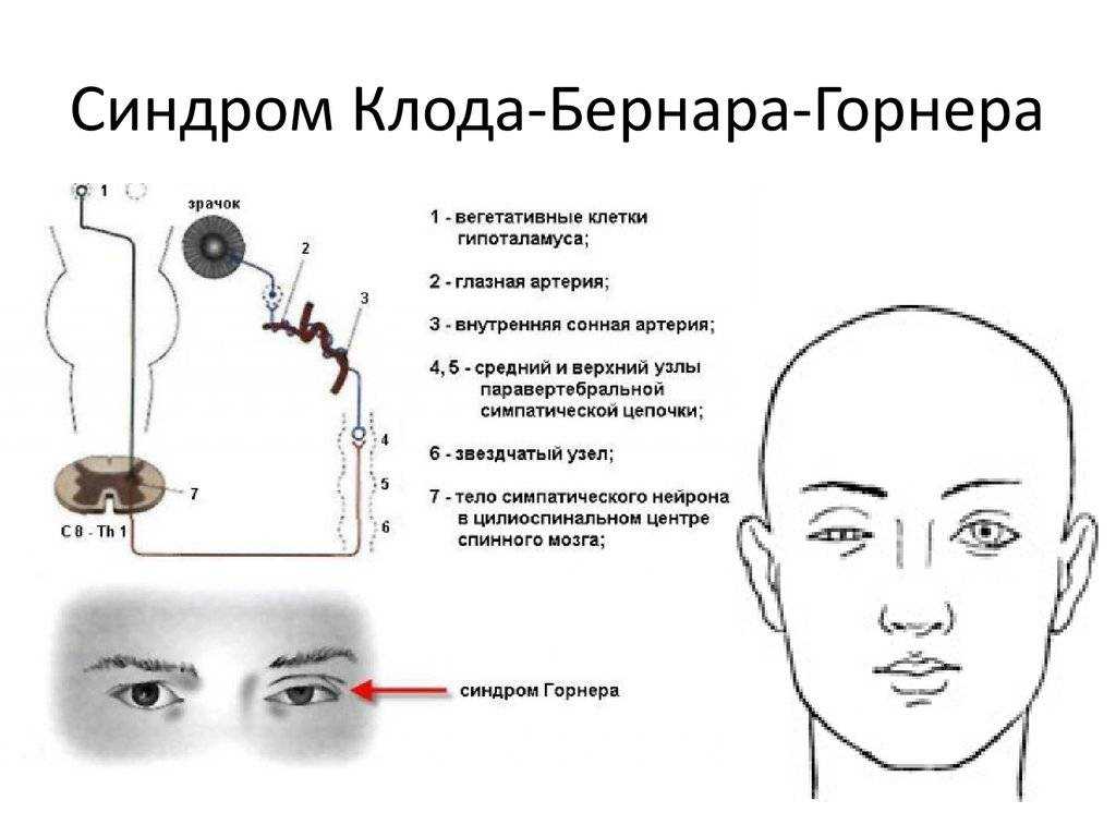Синдром хорнера у кошек - причины и лечение | прохвост