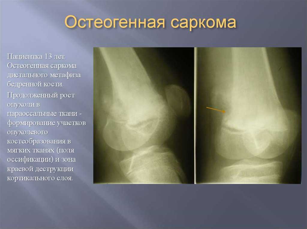 Остеосаркома у собак - причины, симптомы и лечение