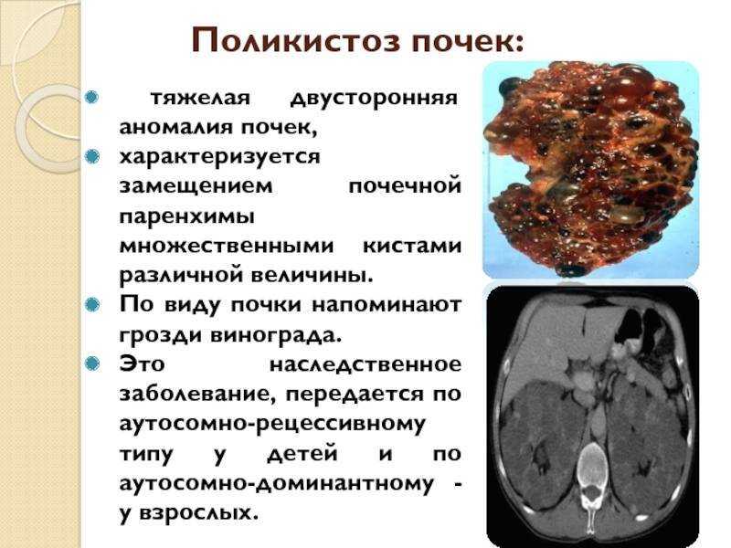 Киста у котов и кошек