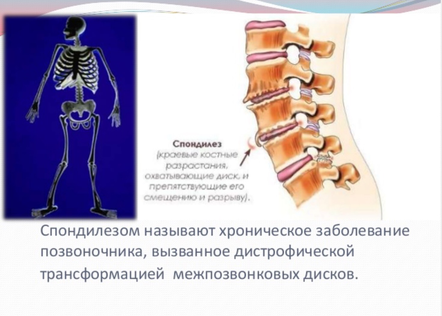 Спондилез у собак. спондилез у собак - симптомы и лечение