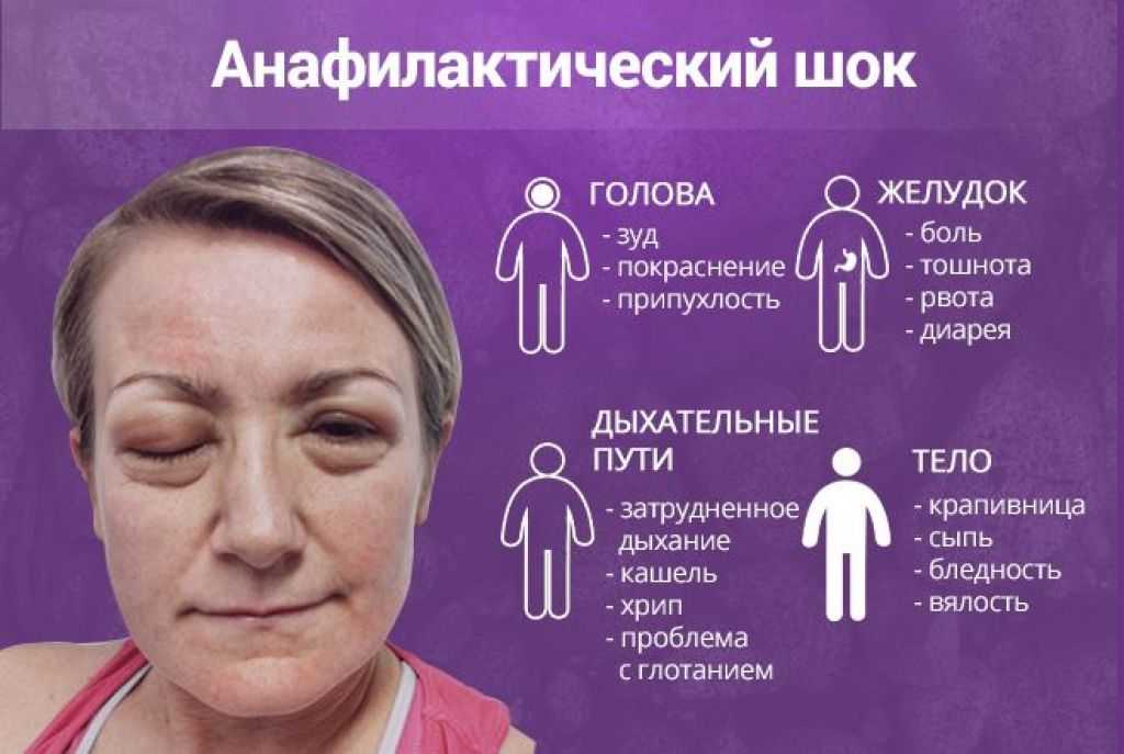 Аллергия у кошек: симптомы и лечение