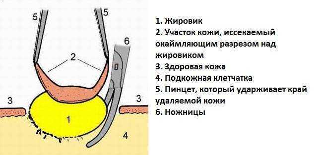 Атерома кожи у кошек » собачки и кошечки