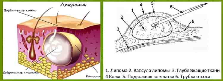 Отчего появляются жировики у собаки?