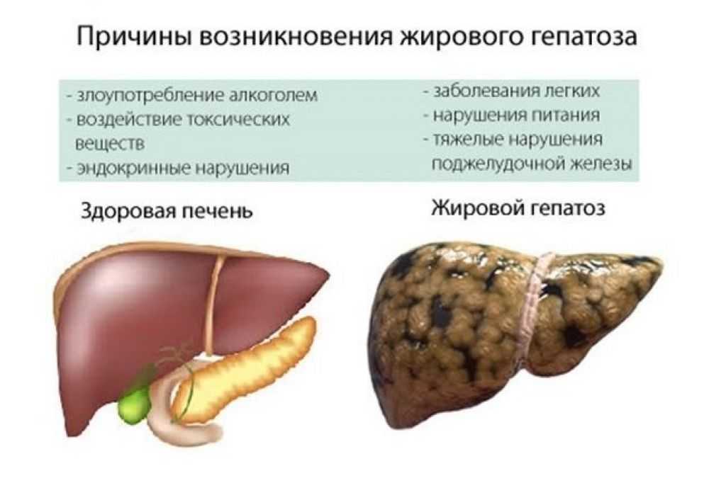 Болезни печени и желчного пузыря у собак