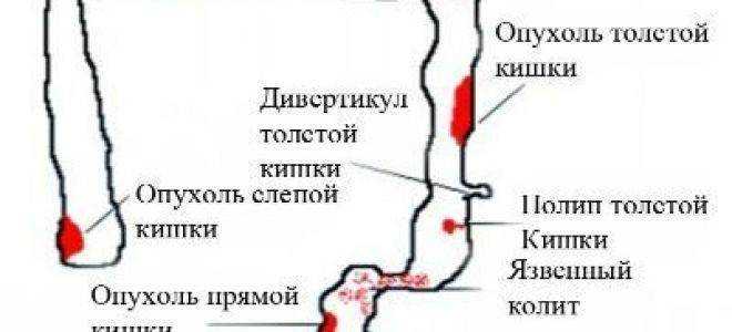 Кровь в кале у кота: причины появления