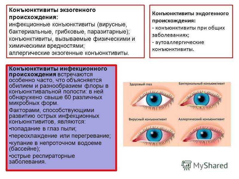 У собаки гноятся глаза: как лечить?