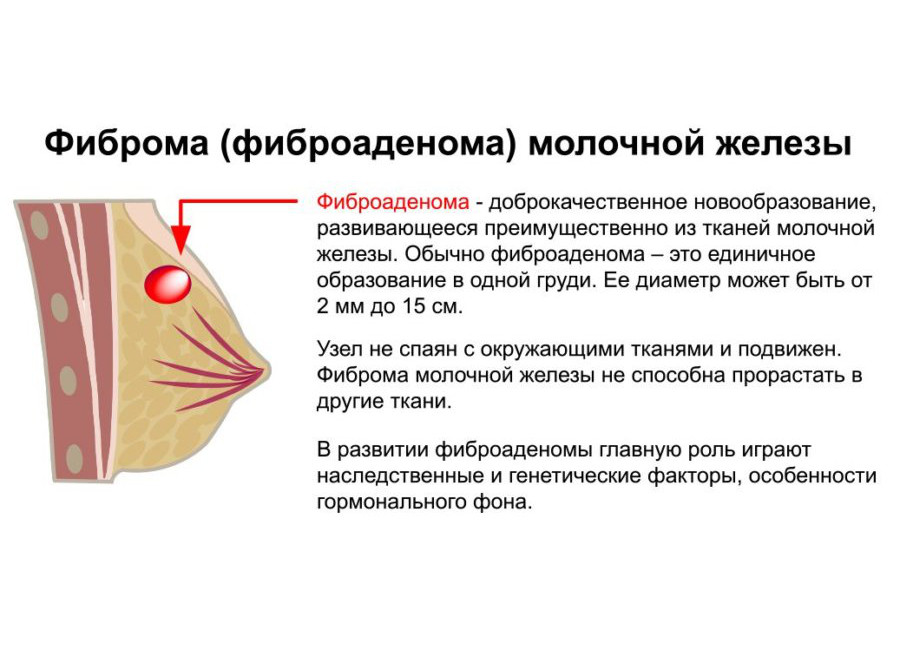Мастопатия у кошек: причины возникновения опухоли молочной железы у кошек (профилактика и методы самостоятельной диагностики)