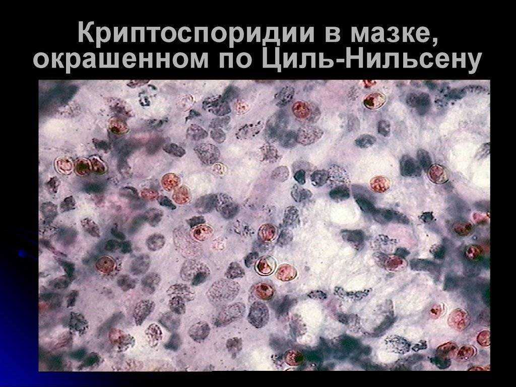 Лечение криптоспоридиоза у кошек
