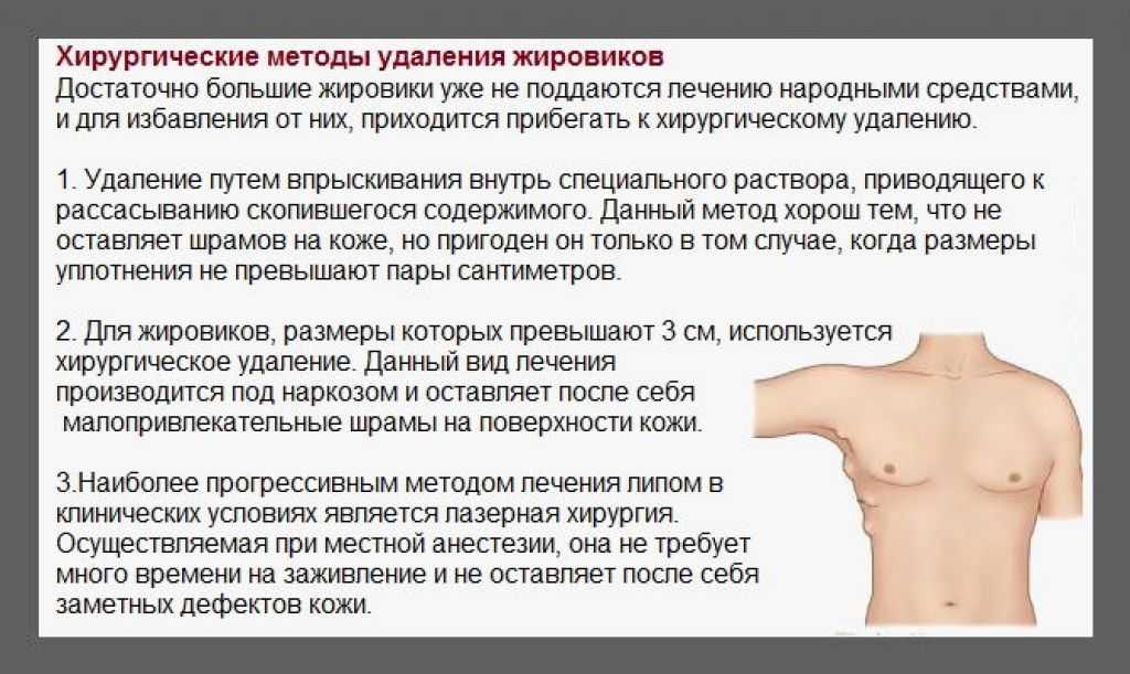 Жировик у собаки: как лечить в домашних условиях, что делать