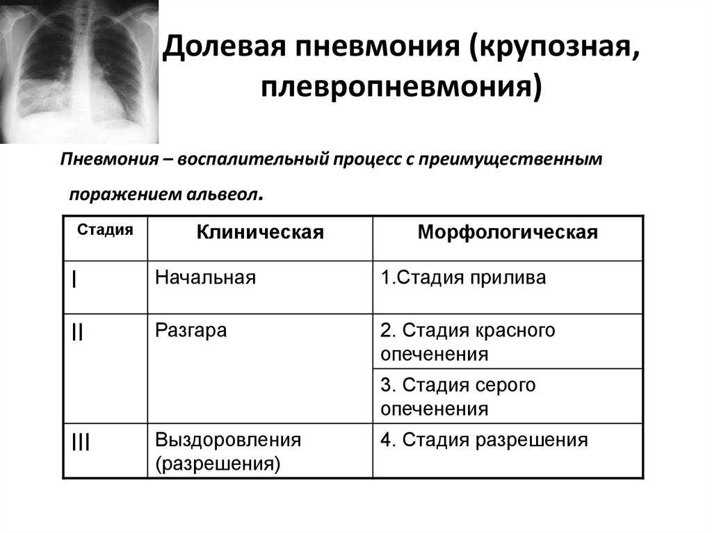 Причины и последствия пневмонии у кошек | плюсы и минусы