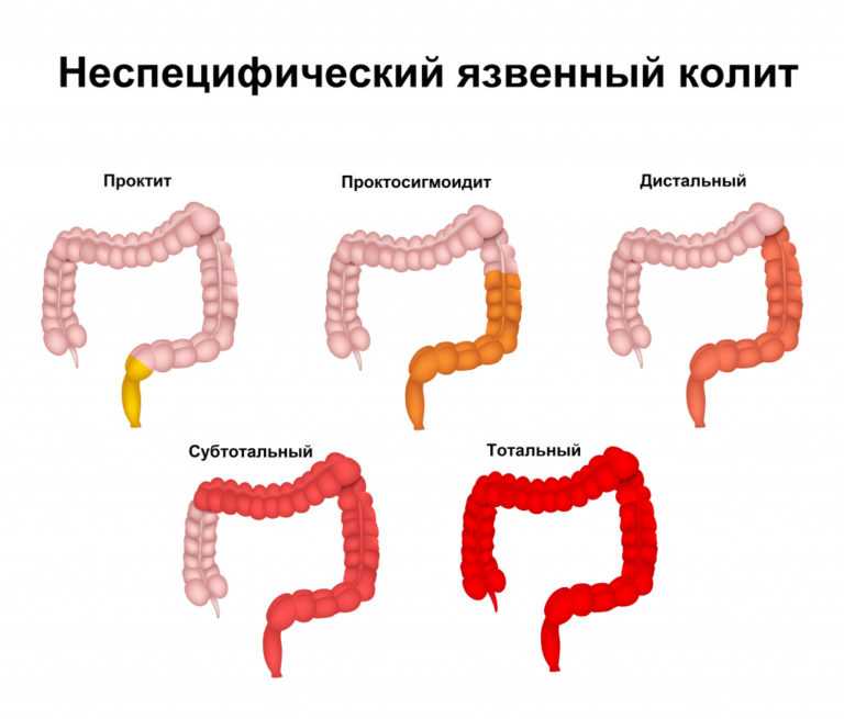 Колит (хронический, язвенный) у собак - симптомы, лечение, препараты, причины появления | наши лучшие друзья