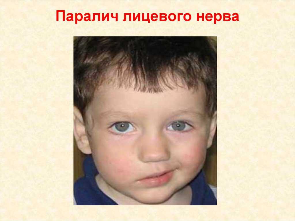 Заболевания, от которых собака перестает лаять | мир собак