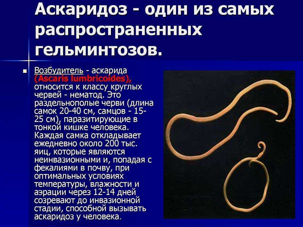 Аскаридоз