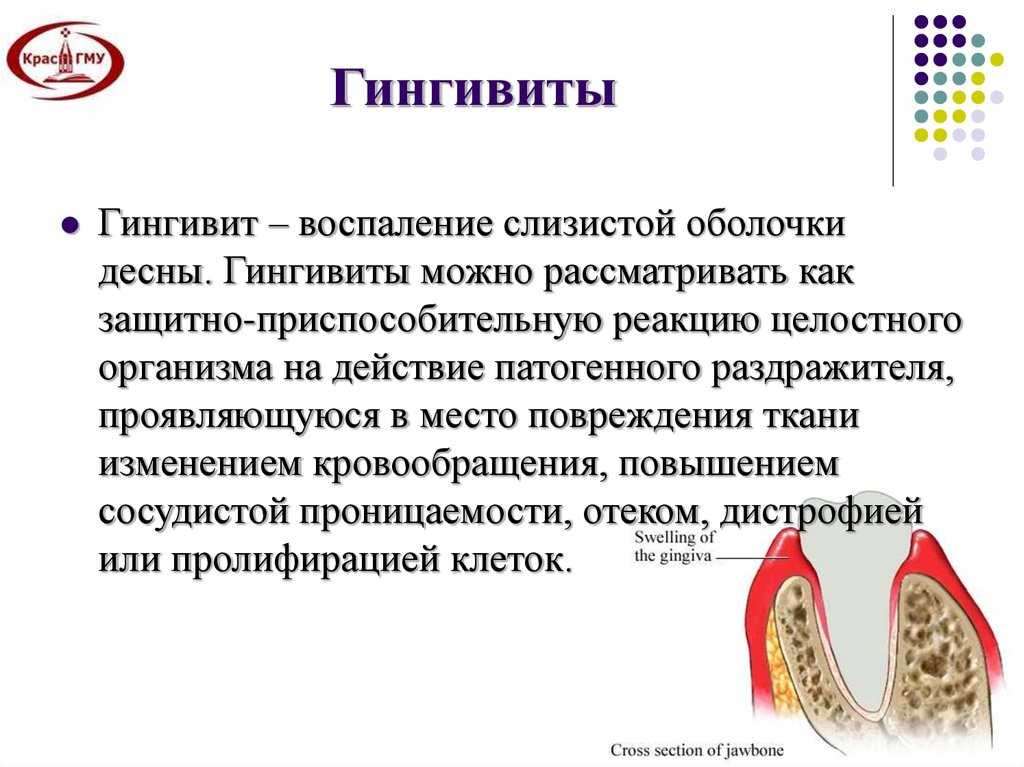 Профилактика заболеваний зубов у кошек