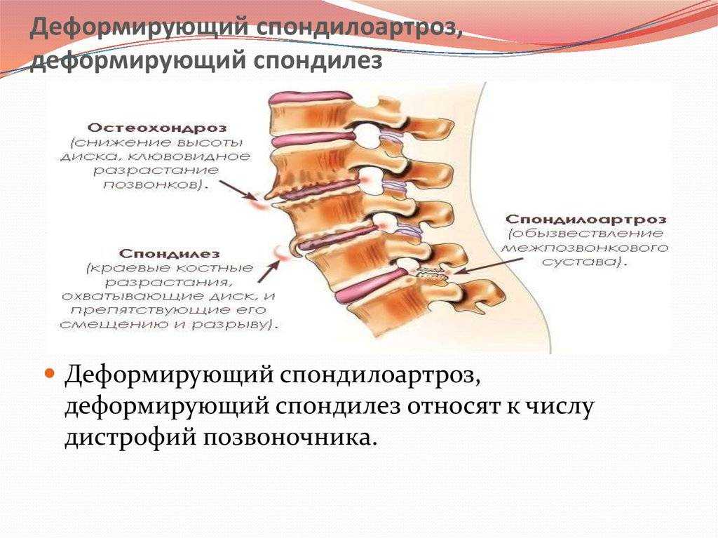 Болезнь межпозвоночных дисков у собак