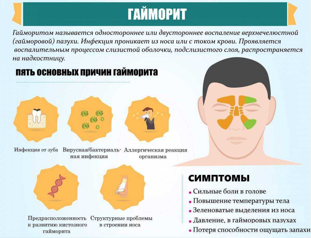 Сопли у кошек: почему появляется насморк у кошек, причины насморка у кошек, как промывать носовые ходы