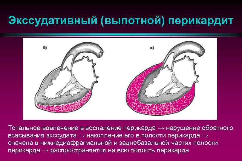 Перикардит у кошек: основные патологии вызывающие воспаление_ | wwwcat.ru