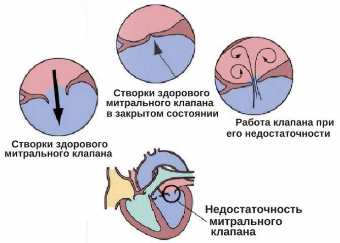 Недостаточность митрального клапана у собак