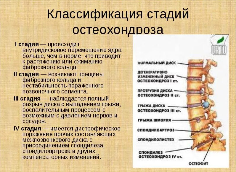 Спондилёз: заболевание позвоночника у собаки