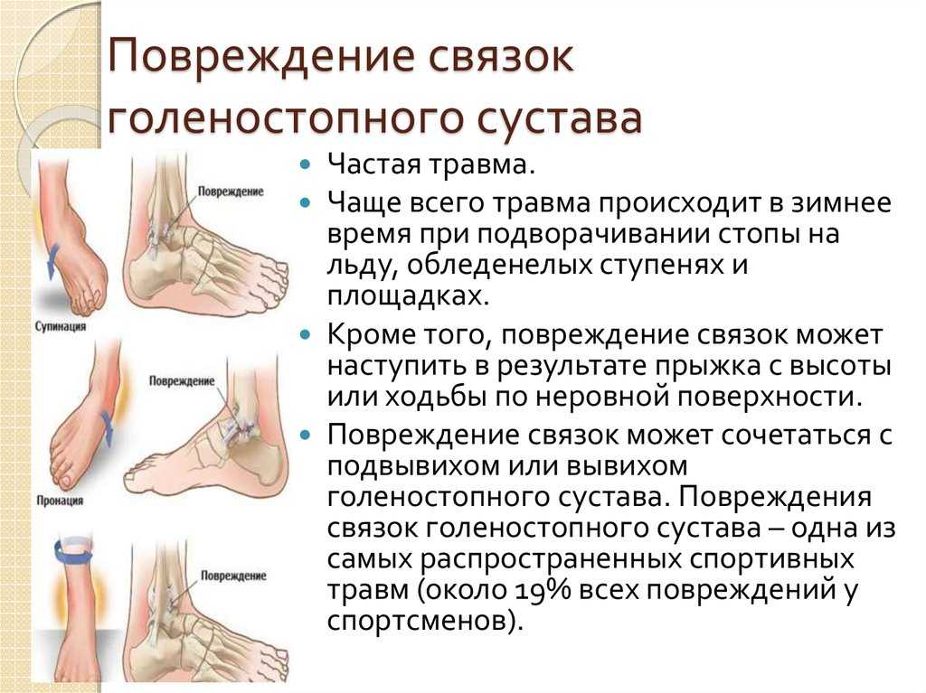 Вывих у собаки и кошки: признаки, симптомы, диагностика, лечение в аист-вет