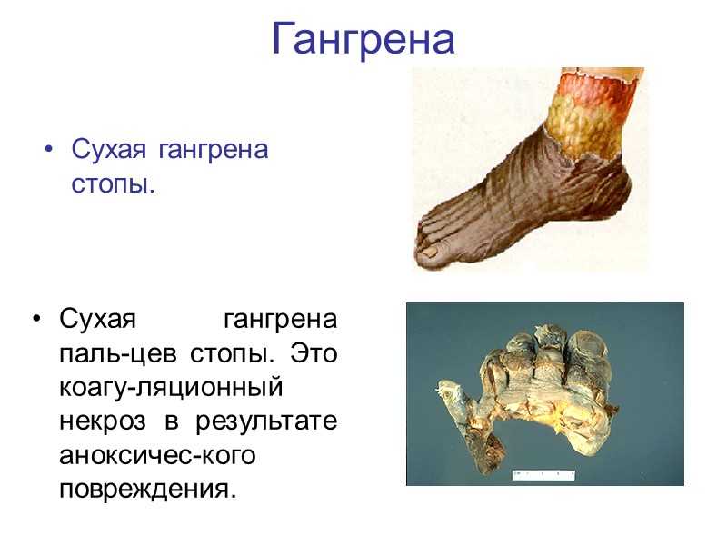 Газовая гангрена - зооветеринарный портал беларуси 1vet.by