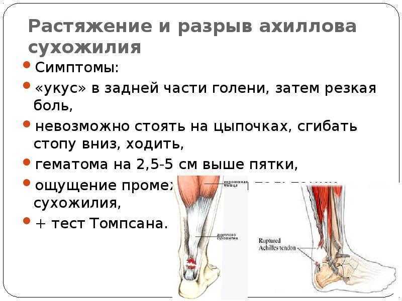 Что делать в домашних условиях при вывихе передней лапы у собаки